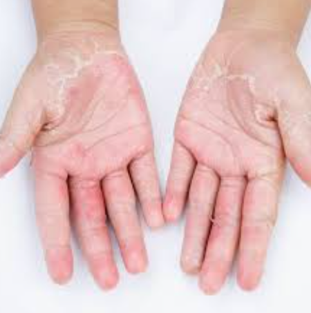 Hand