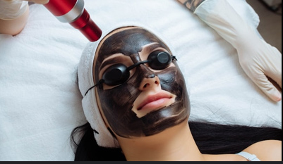Carbon Facial